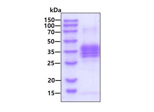 3 μg by SDS-PAGE under reducing condition and visualized by coomassie blue stain